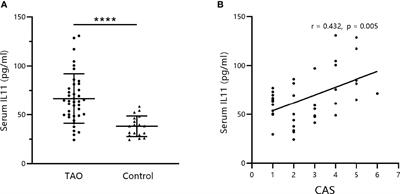 IL-11 Is Elevated and Drives the Profibrotic Phenotype Transition of Orbital Fibroblasts in Thyroid-Associated Ophthalmopathy